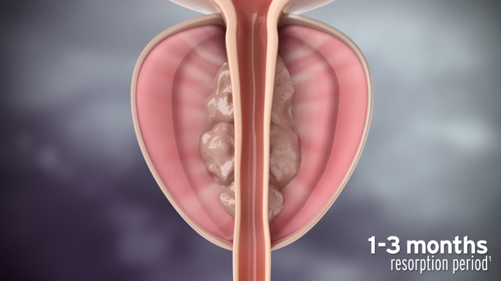 前立腺肥大症外来2